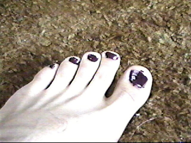 Toenails pained black